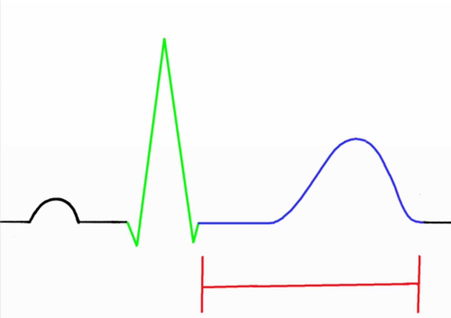 <p>time from the end of ventricular depolarization to ventricular re-polarization completion</p>