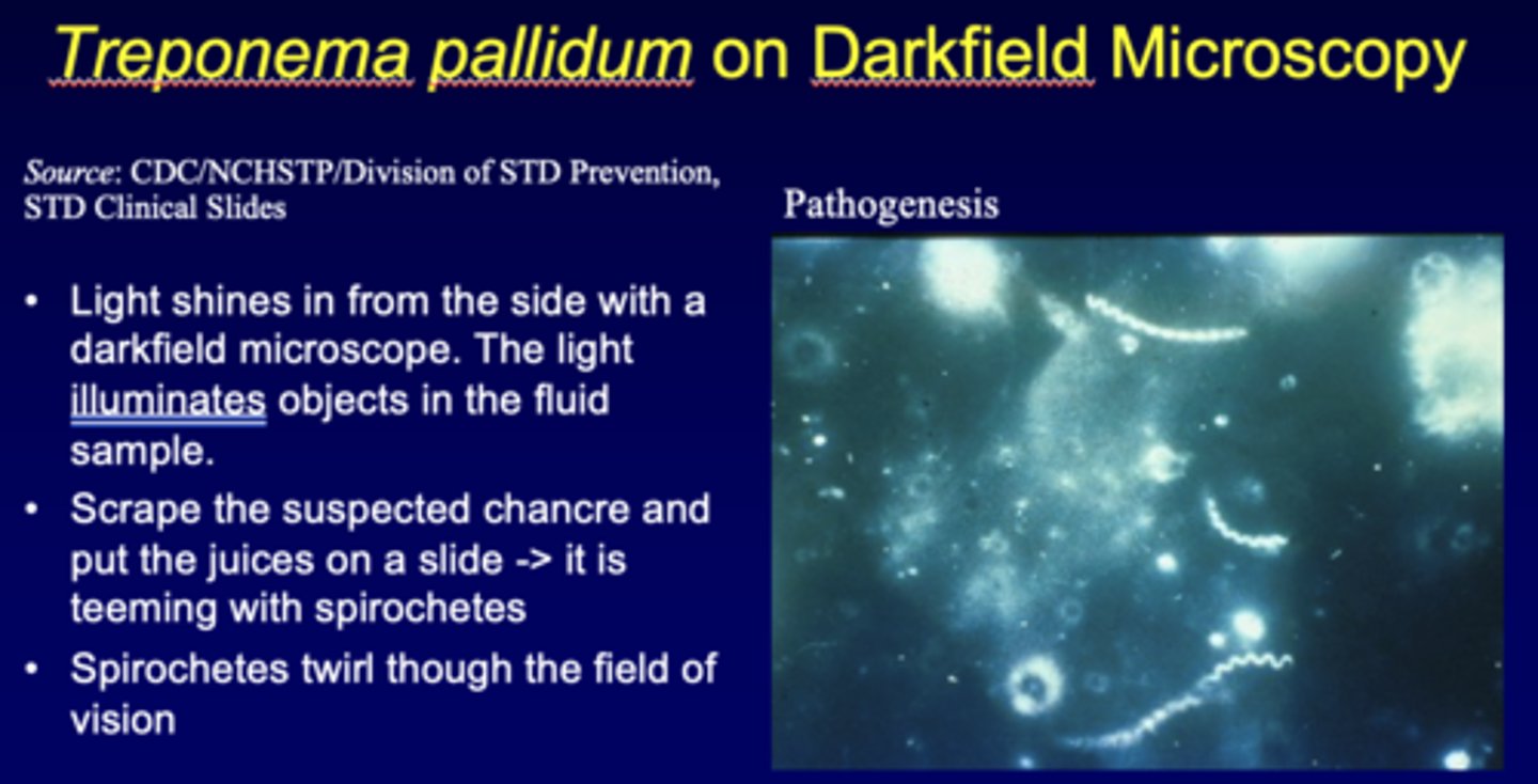 <p>darkfield microscopy</p>