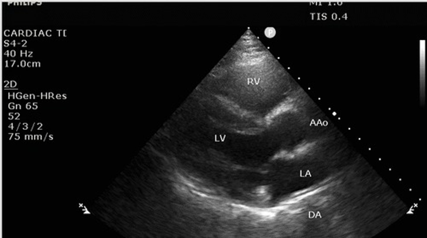 <p>What view of the heart is this?</p>