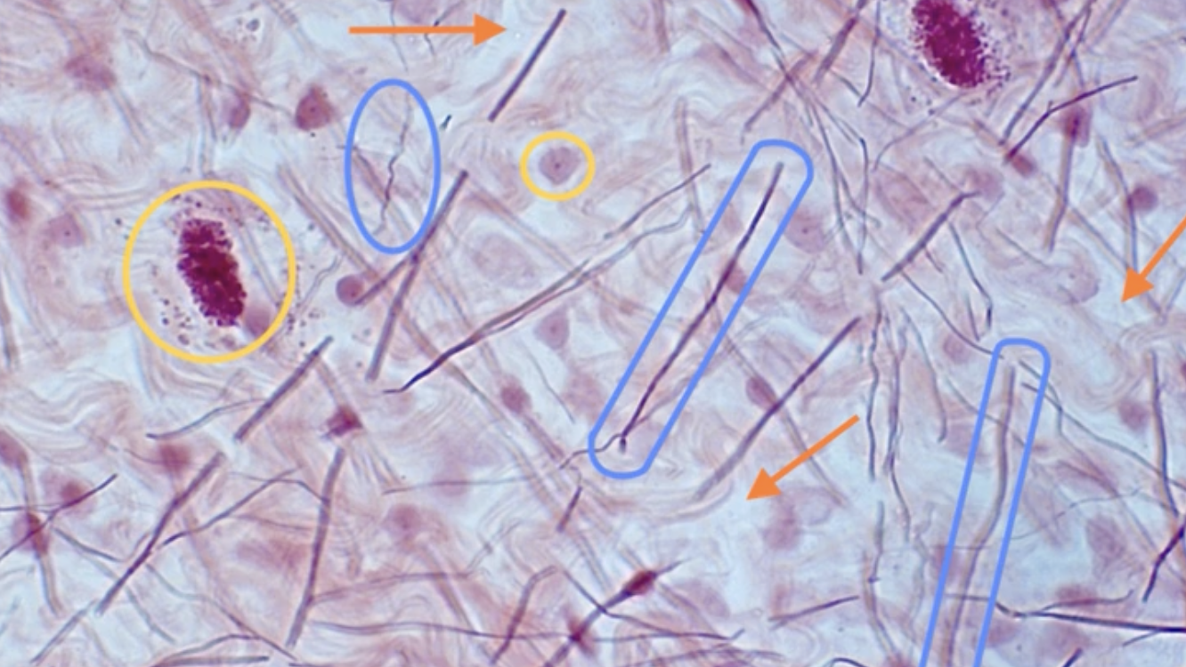 <p>What is the orange arrow pointing to?</p>