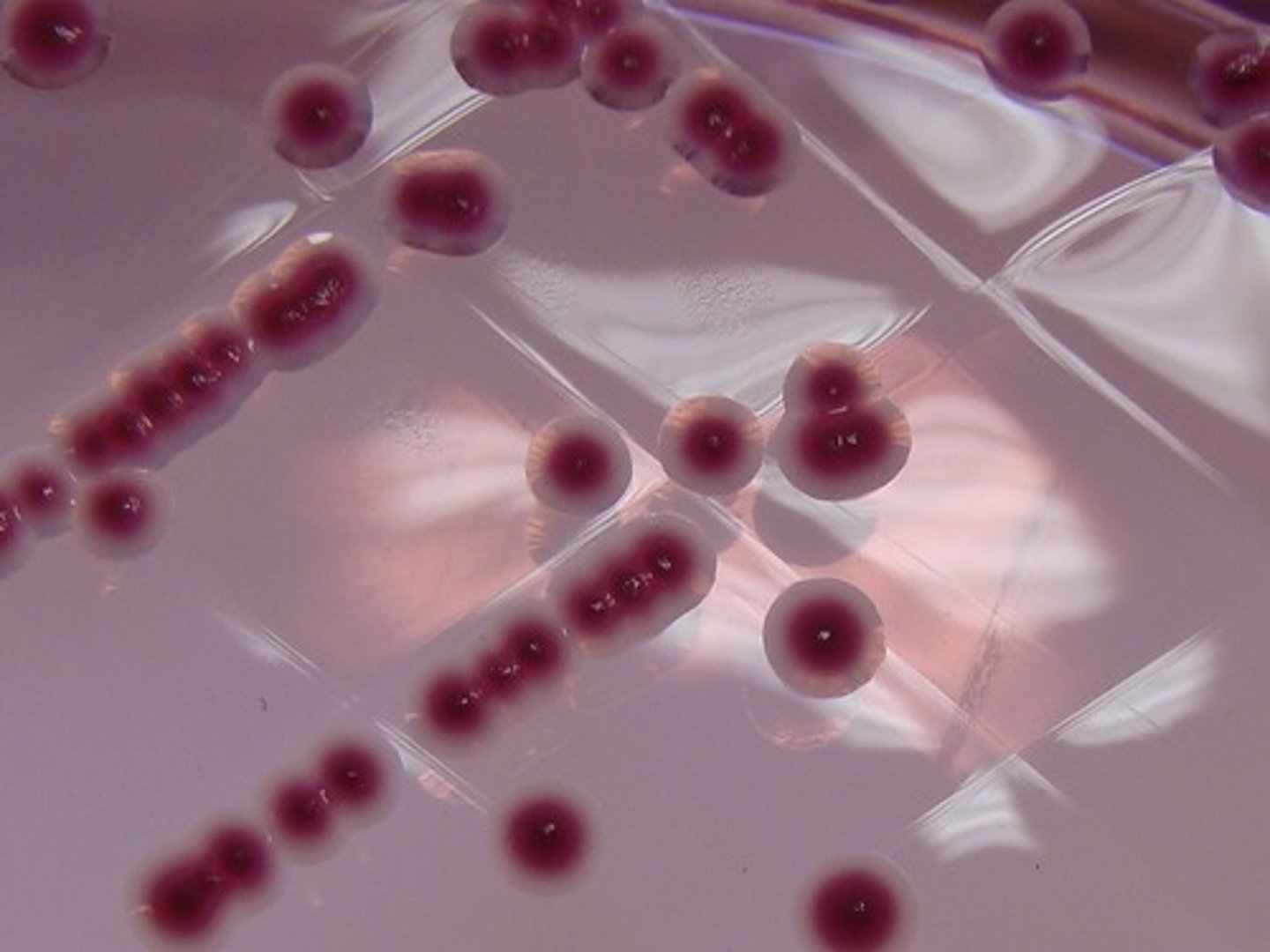 <p>C.I.N.- Cefsulodin-Irgasan-Novobiocin.</p><p>C.I.N. agar inhibits the growth of many other organisms from Enterobacteriaceae.</p>
