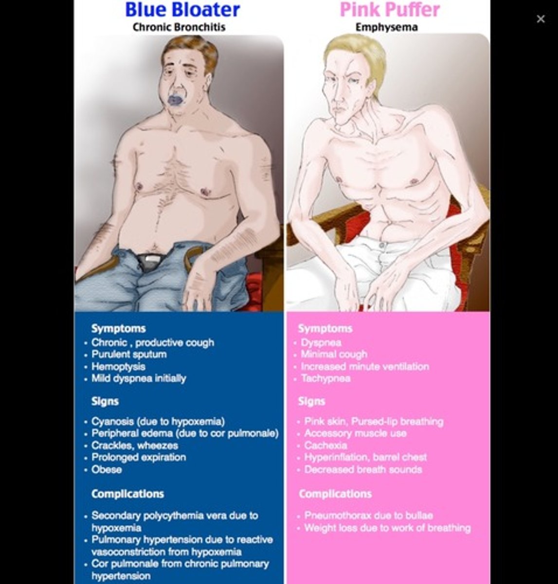 <p>Dyspnea, hyperventilation (emphysema)</p>
