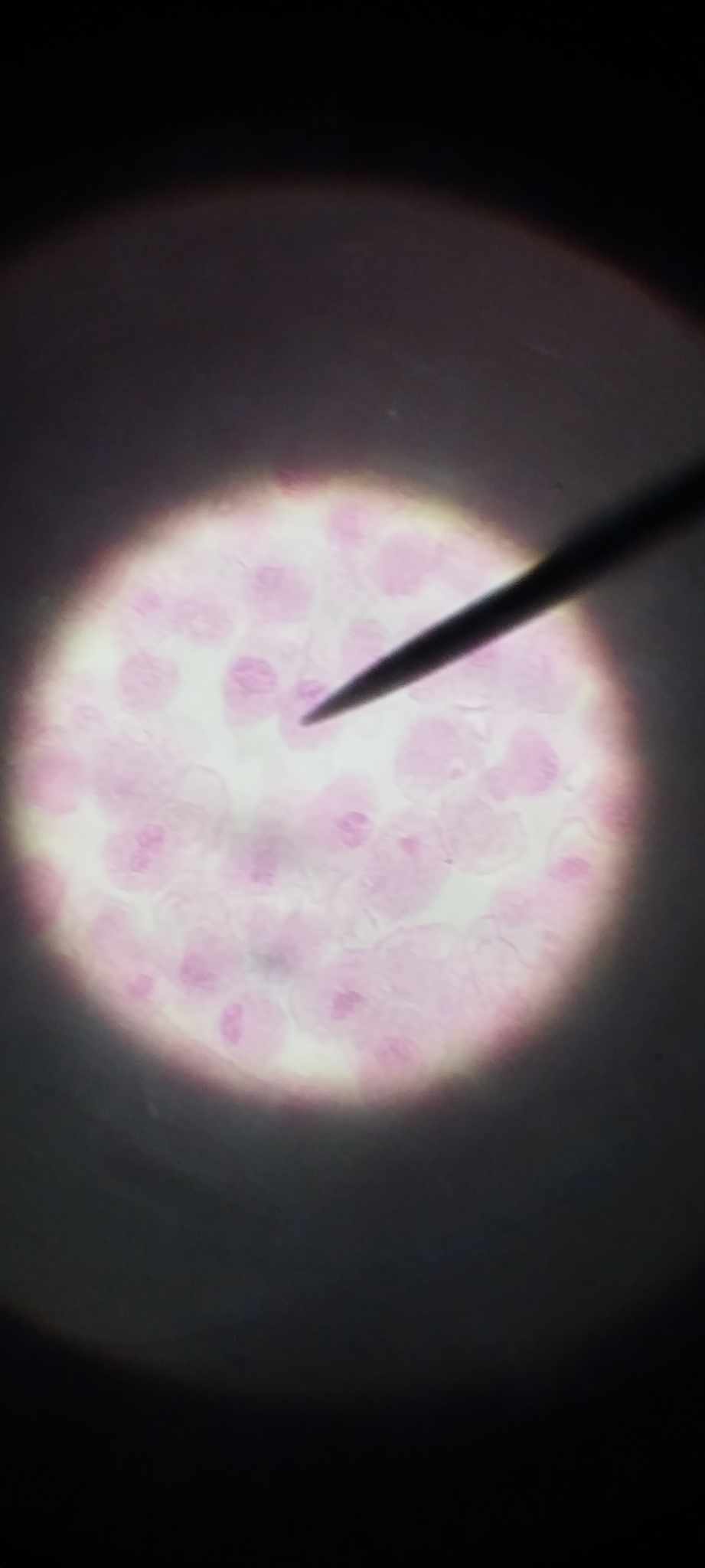 <p>chromosomes are coiling, shortening, and thickening; chromosomes are irregular threads and each is composed of two chromatids; nucleus disappears and nuclear membrane disintegrates</p>