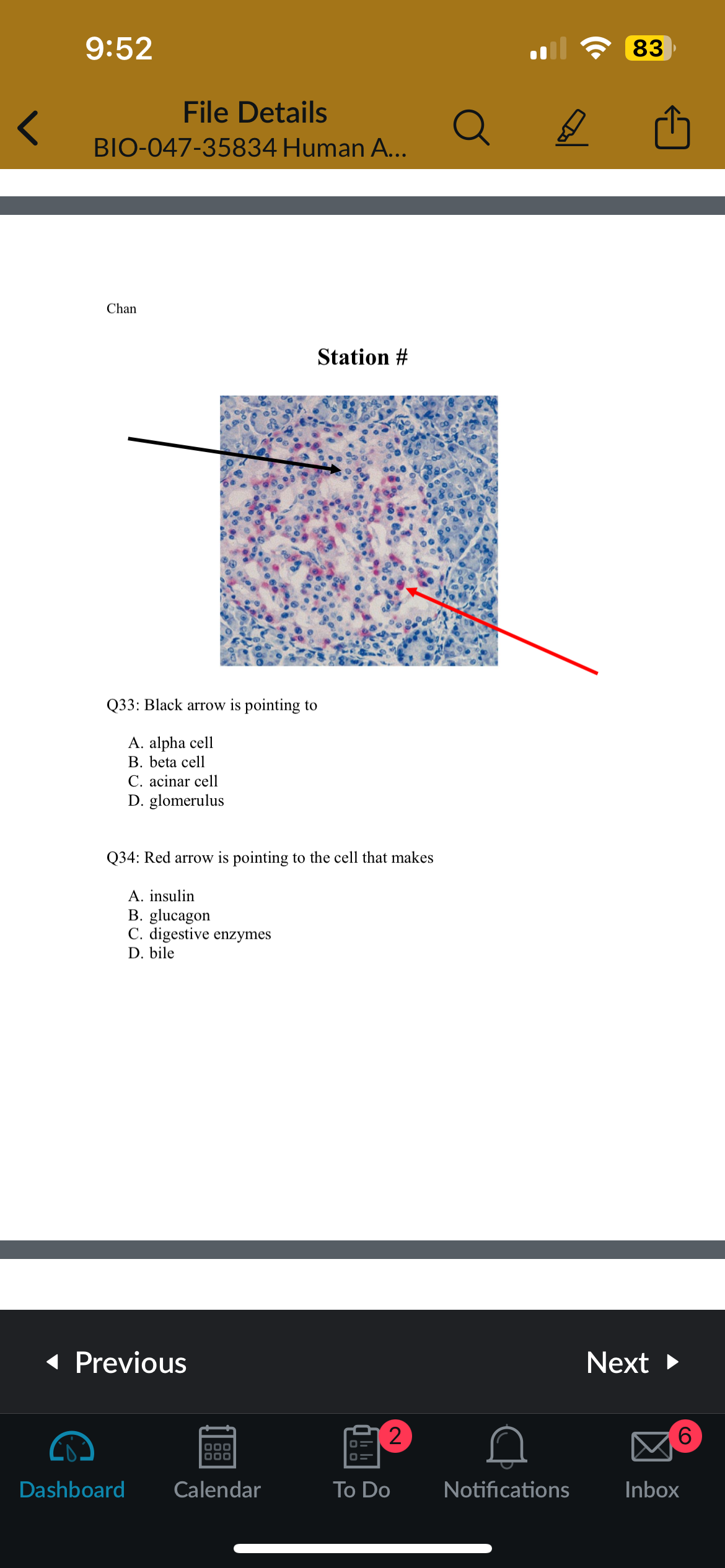 <p>Q34: Red arrow is pointing to the cell that makes</p>