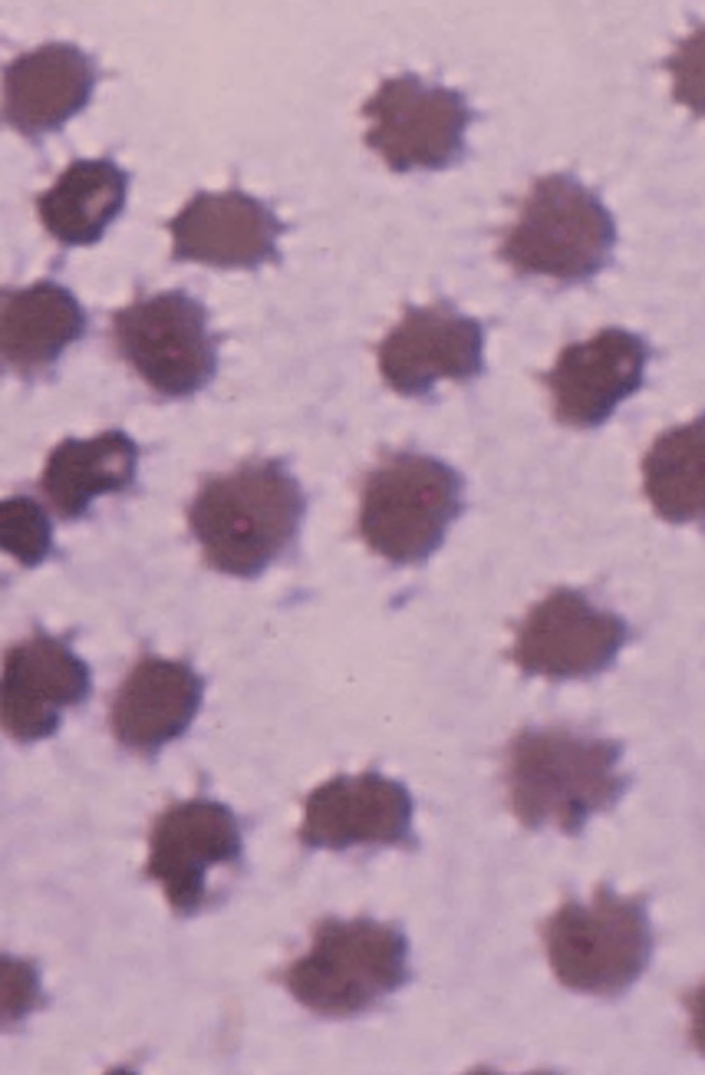 <p>describe the rbc</p>