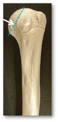Name the specific part of this bone indicated by the blue line.