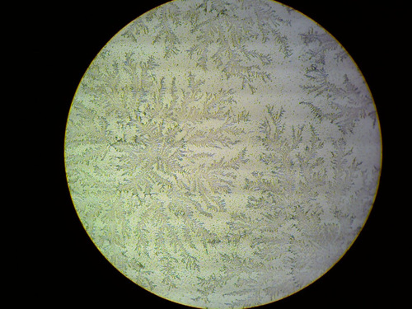 <p>Vaginal fluid spread on slide, allowed to dry</p><p>Ferm-like crystals seen = positive for amniotic fluid</p>