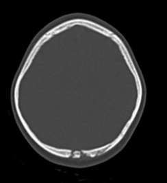 <p>What is the pathology?</p>