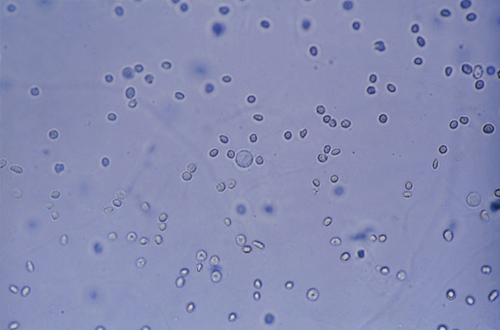 <p>cells will shrink due to loss of water and may appear crenated or irregularly shaped</p>