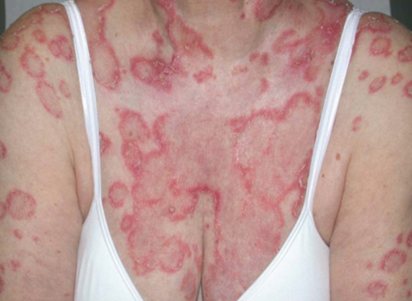 <p>What is the diagnosis?</p>