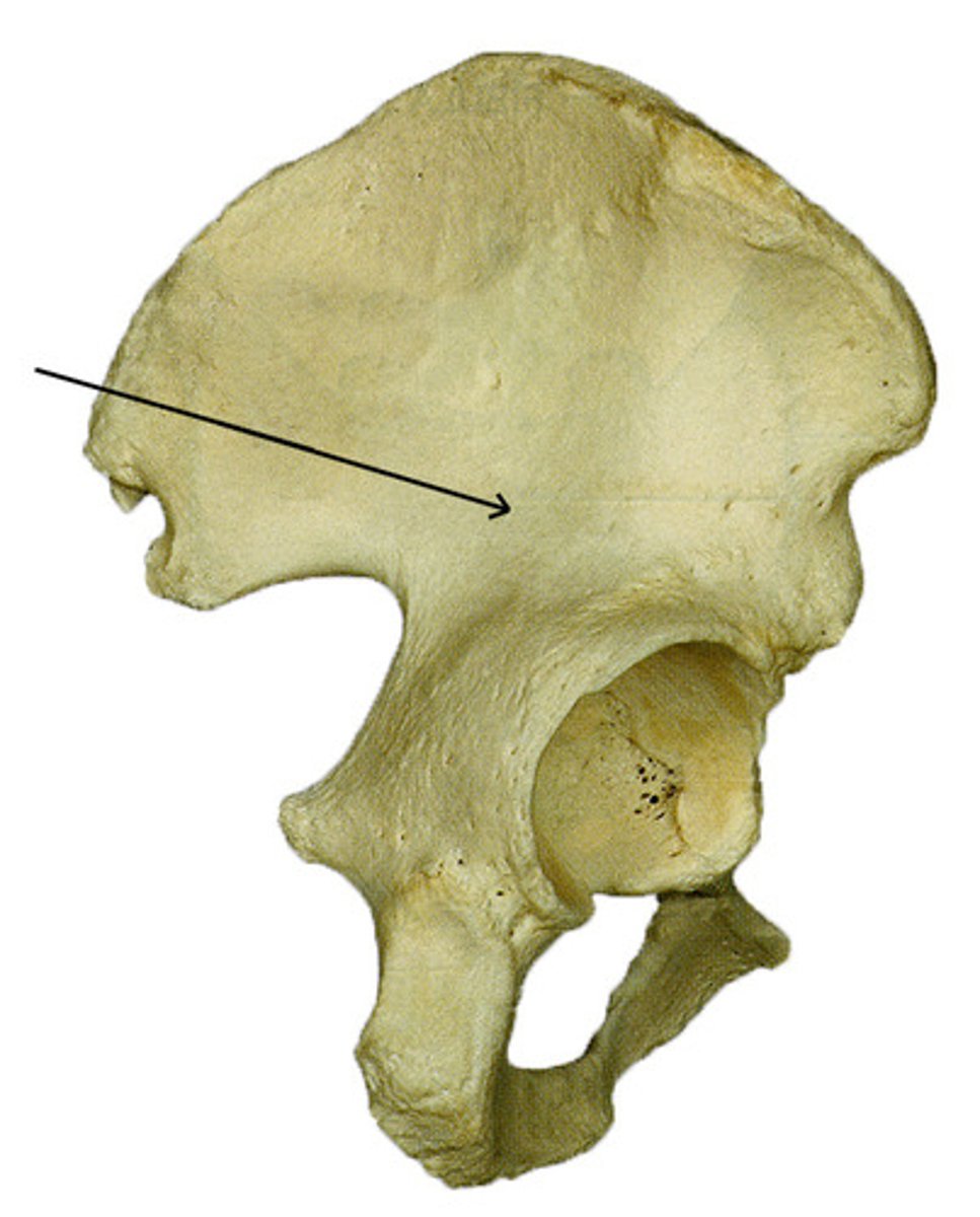 <p>faint, curved bony ridge located on the external surface of the ilium. starts behind the anterior inferior iliac spine and curves down to the greater sciatic notch</p>