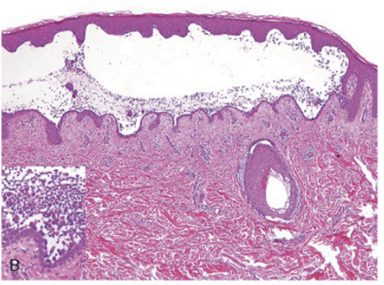 <p>this is a histological slide of:</p>