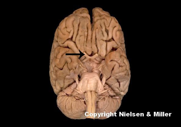 <p><em>what is indicated nerve</em></p>