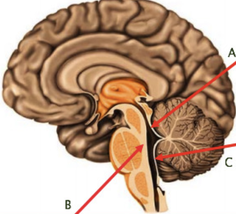 <p>choroid plexus in forth ventricle (A and C)</p>
