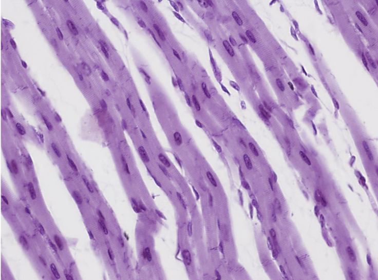 <p>What type of muscle tissue is this?</p>