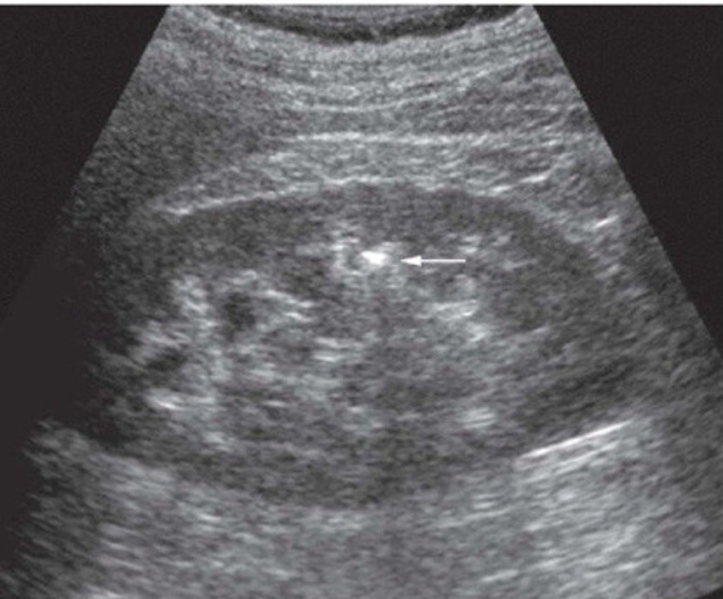 <p>What does this image show</p>