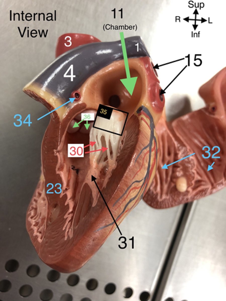 <p>36. The valve that prevents backflow from the aorta into the left ventricle.</p>