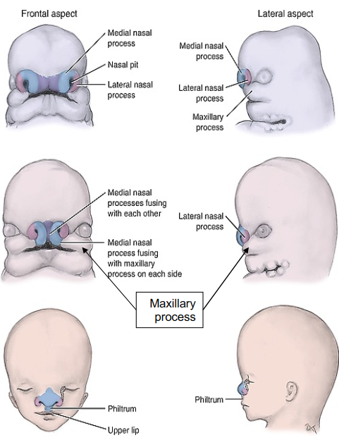 <p>Frontonasal process → medial and lateral nasal process → </p><ul><li><p>Medial nasal process → forms globular process (aka intermaxillary segment to form the part of the palate), center of the upper lip (philtrum) </p></li><li><p>Left and right lateral process → forms the ala of the nose (side of the nose/nostrils) </p></li></ul><p></p>
