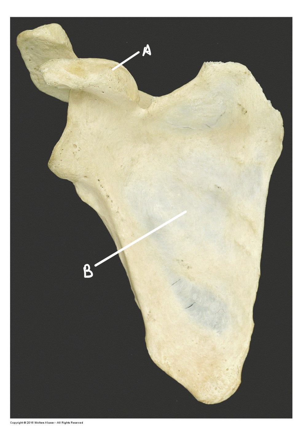 <p>A</p>