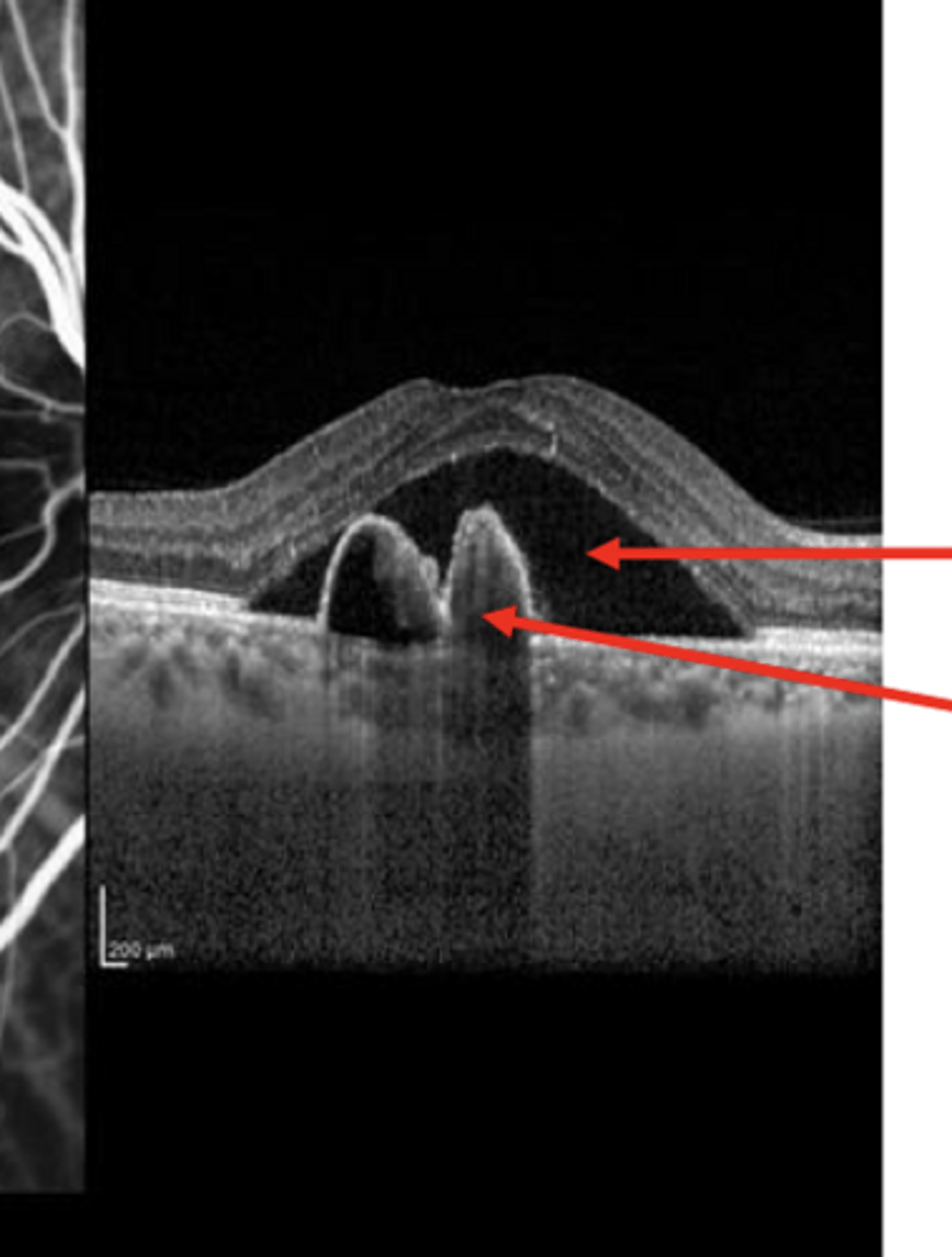 <p>What is present in this pic?</p>