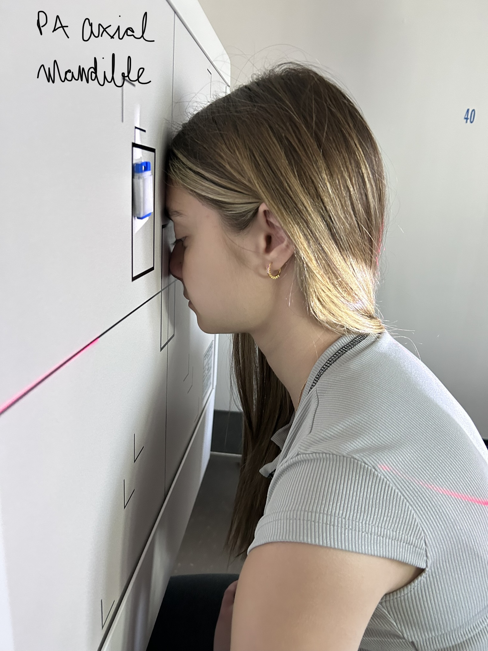 40” SID, 8” x 10” lw collimation, 25º cephalic angle (115º on tube), MSP And OML perpendicular to IR, centering at MSP and exiting through acanthion
