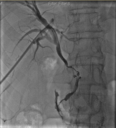 <p>identify the interventional procedure</p>