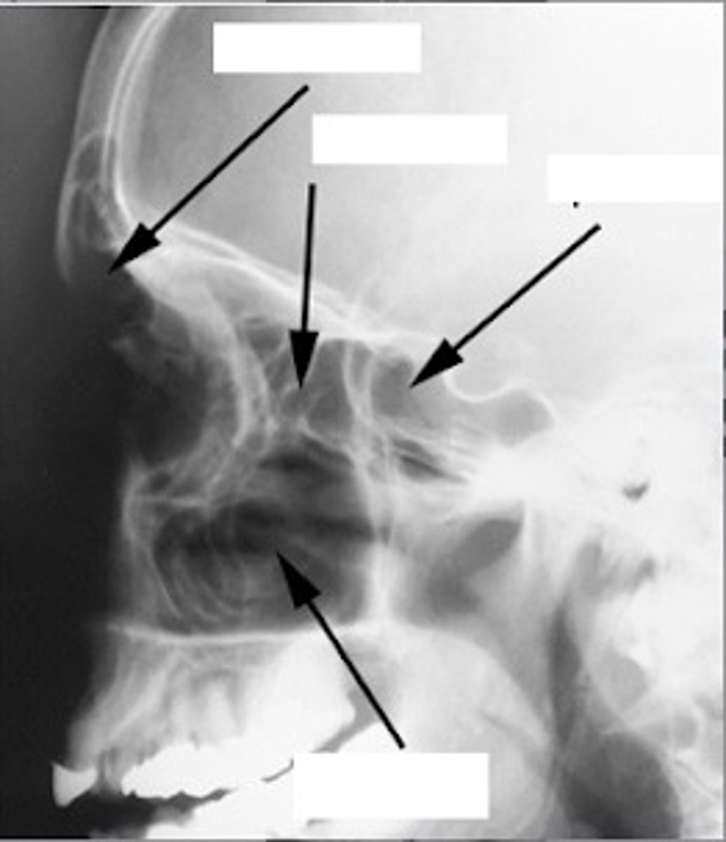 <p>What position/projection?</p>