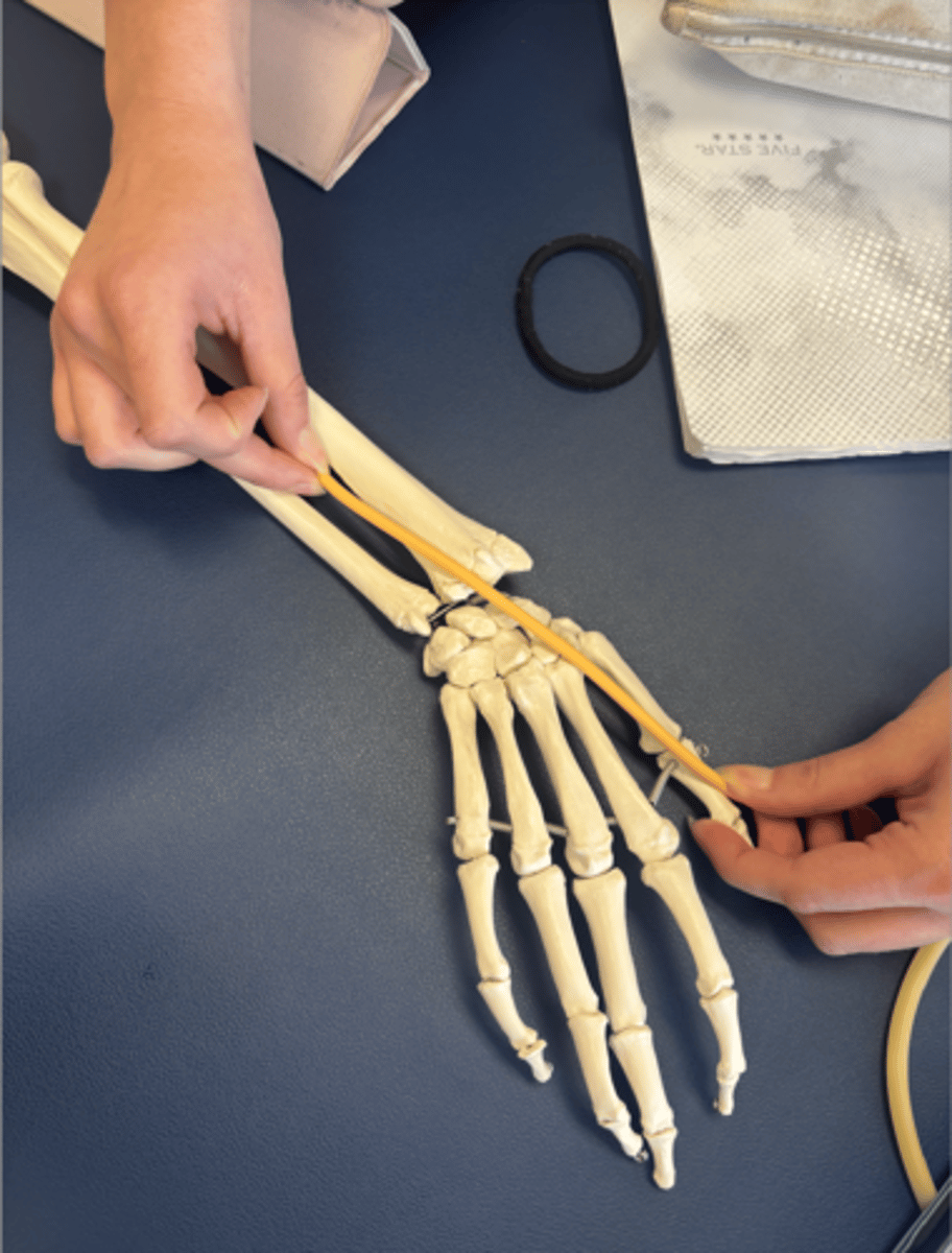 <p>What is this muscle?</p>