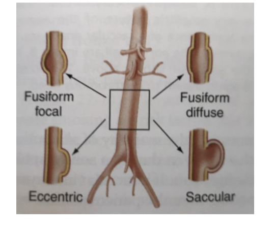 <p>what are the different types of aneurysms</p>