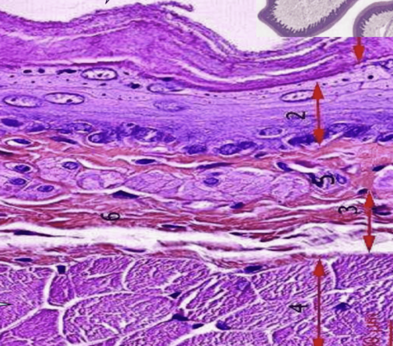 <p>esophagus- what species? why?</p>