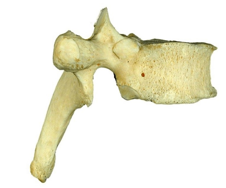 <p>Thoracic (Lateral view)</p>