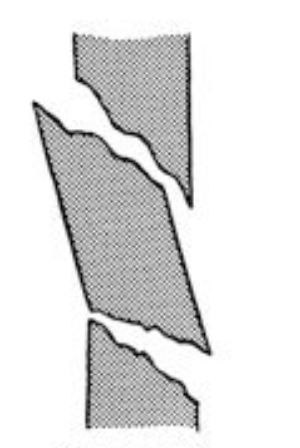 <p>What classification of fracture is this?</p>