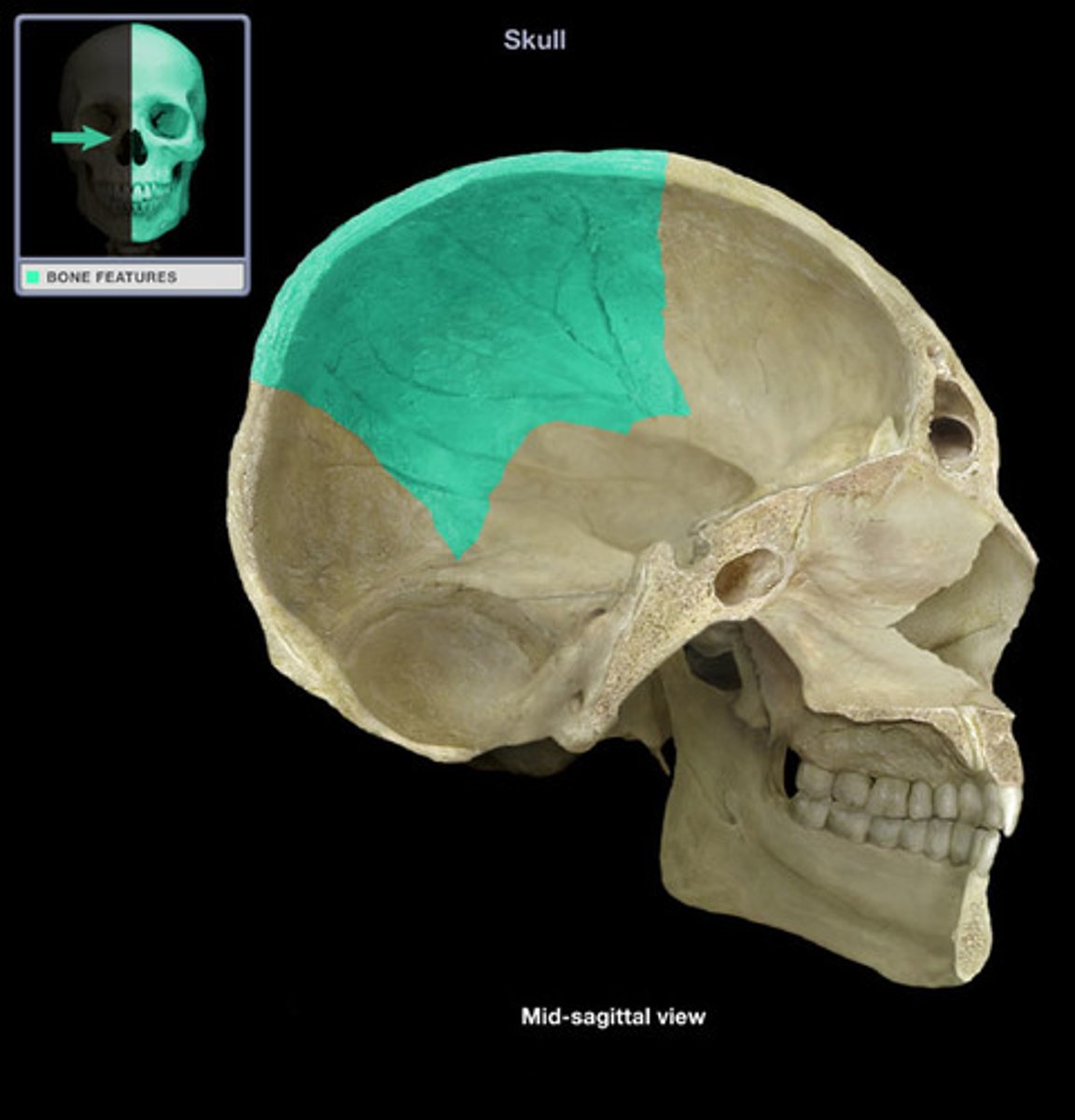 <p>top of head</p>