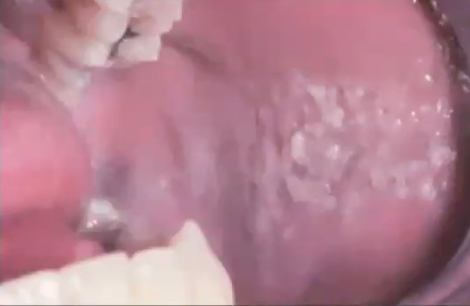 <p>what is the diagnosis</p>