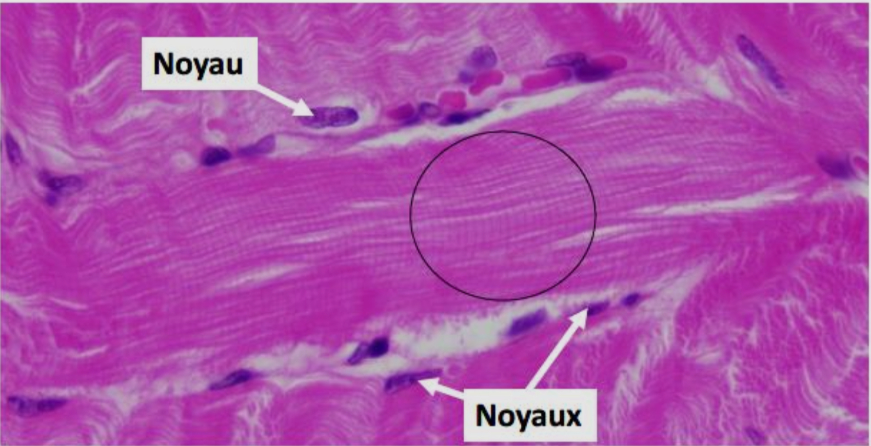 <p>Qu’observe sur cette coupe histologique de muscle strié squelettique après coloration HES</p>