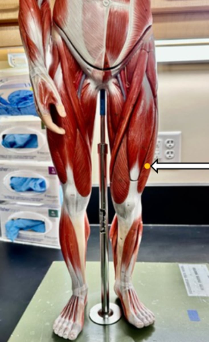 <p>vastus lateralis (function)</p>