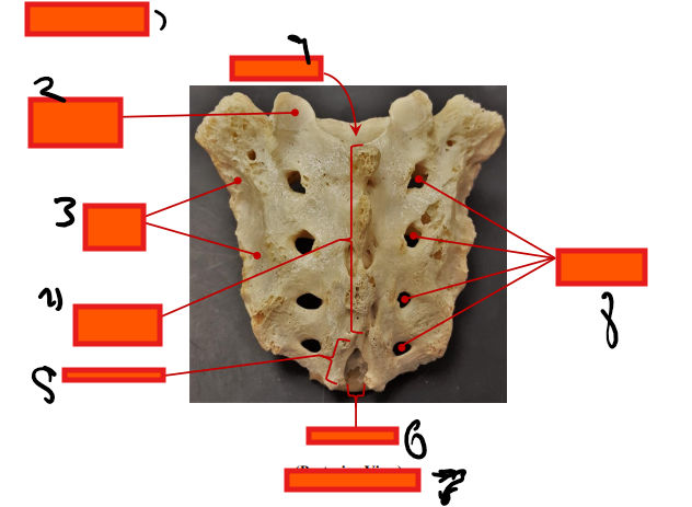 <p>Where is the sacral foramina?</p>