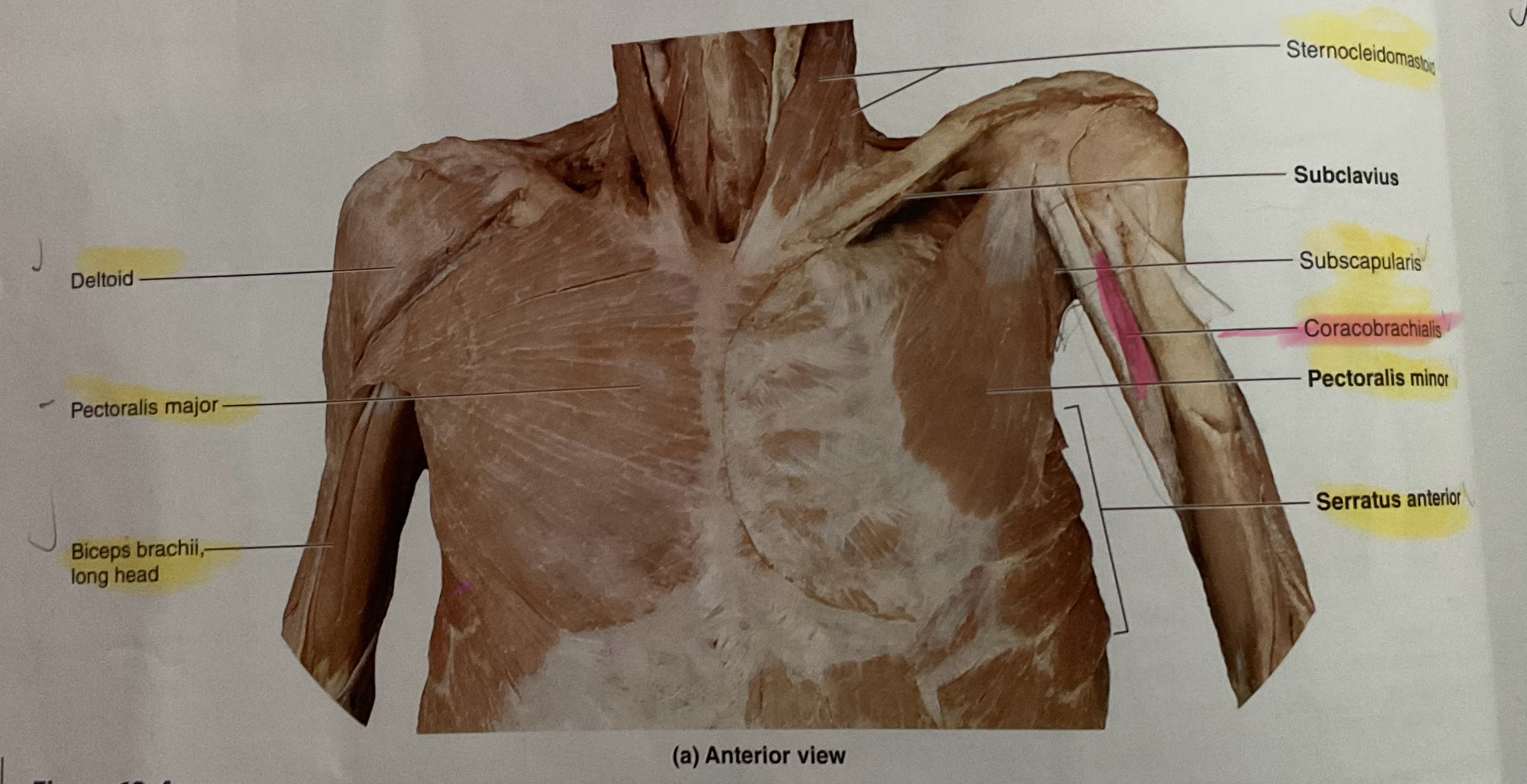 <p>Origin Coracoid process</p><p>Instertion: Medial diaphysis of humerus</p><p>Action: Flex, adduct glenohumeral joint</p>