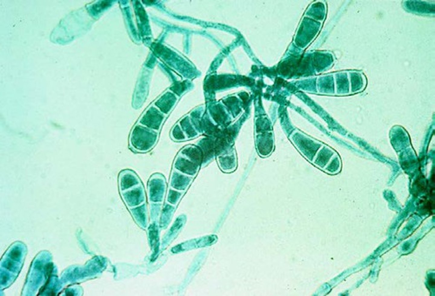 <p>• Skin and nail infections</p><p>• Colony is yellow, olive-gray,</p><p>or khaki</p><p>• Reverse of colony is orange-</p><p>brown</p><p>• Smooth club shaped</p><p>macroconidia with rounded</p><p>ends, often found in</p><p>clusters</p><p>o 2-6 cells</p><p>• No microconidia</p>