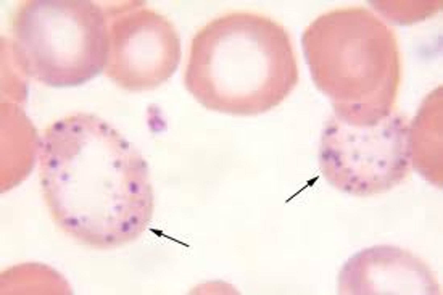 <p>-RNA inclusion<br>lead intoxication</p>