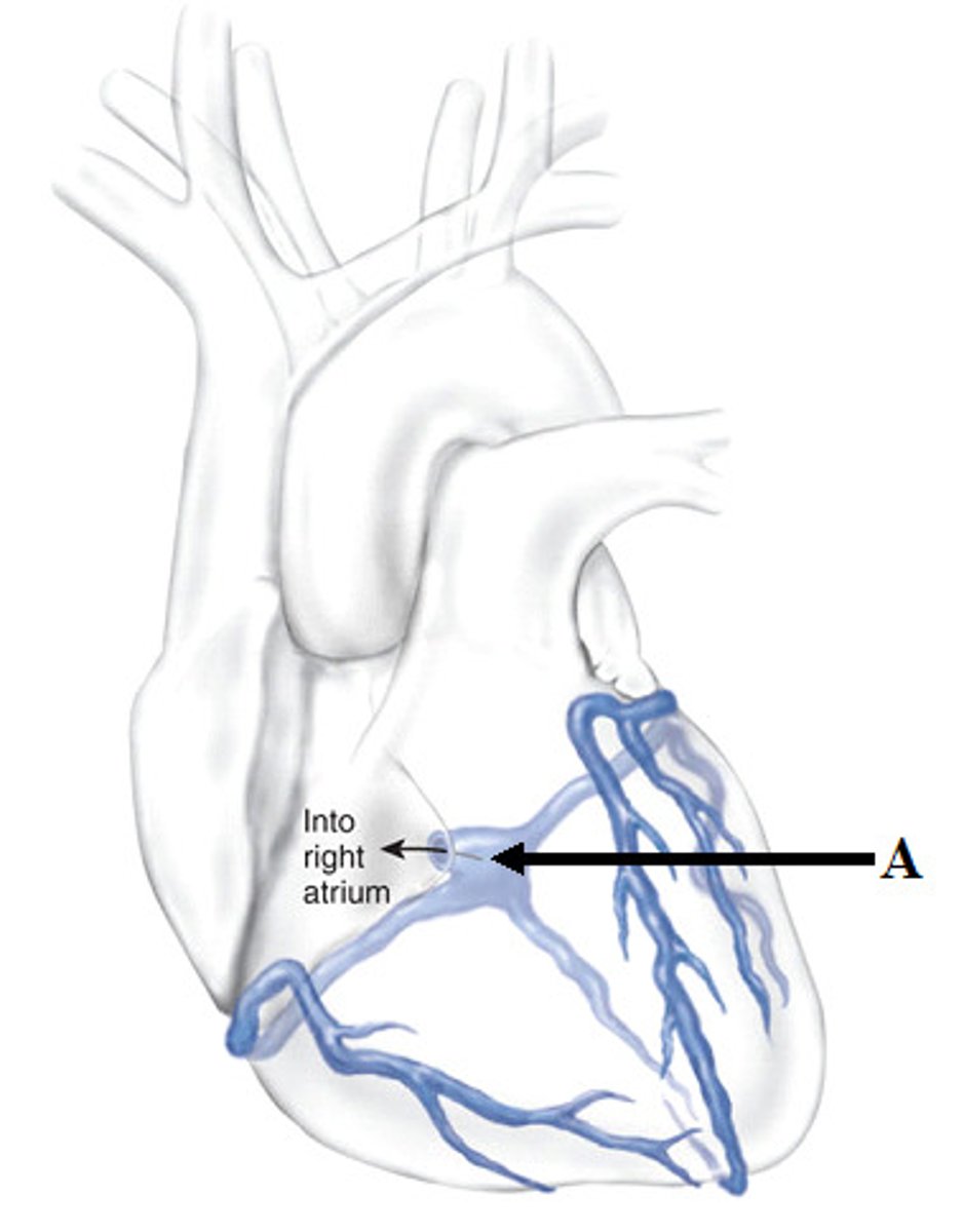 <p>Posterior T ST</p>