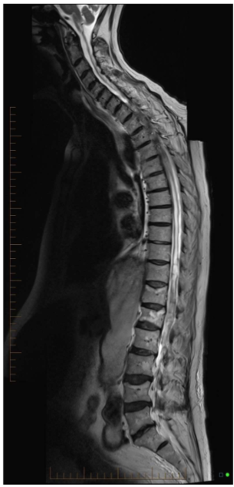 <p>How was this image created? For what clinical indication would you perform this technique?</p>