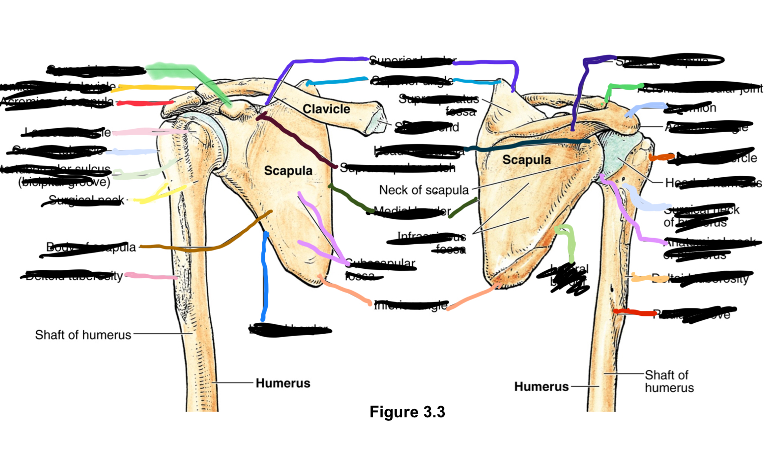 <p>acrominal end of clavicle?</p>