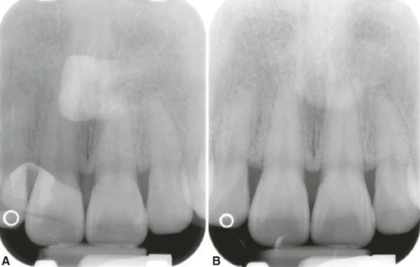 <p>Double image appears dark with super impose structures.</p>