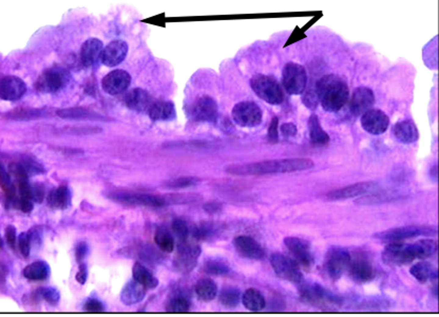 <p>these cells are found in the bronchioles and mostly like the epithelium</p>