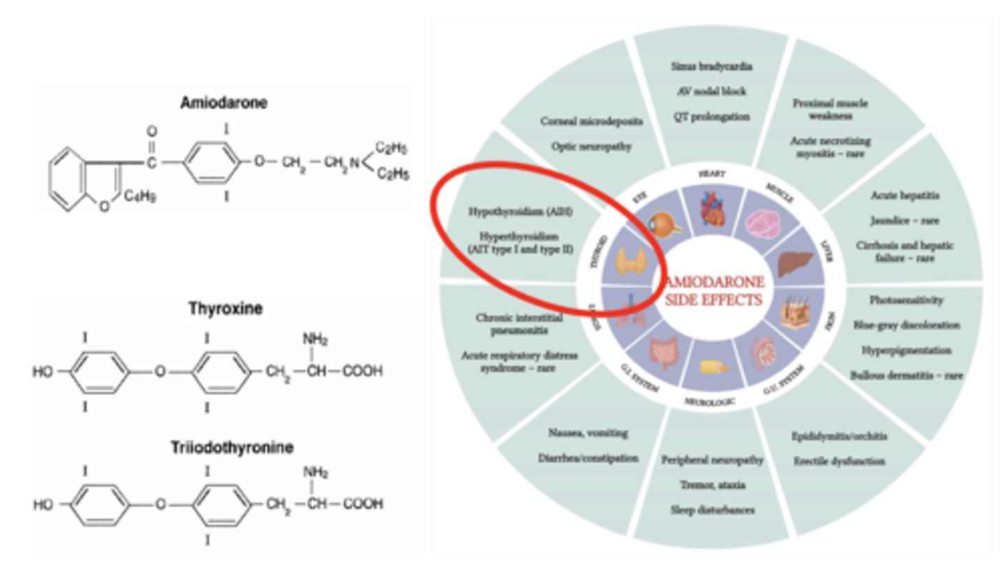 <p>is a class III antiarrhythmic agent commonly used to treat Afib</p><p>Amiodarone-induced hypothyroidism (AIH)</p><p>Amiodarone-induced Thyrotoxicosis (AIT)</p>