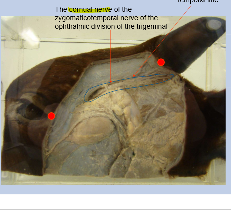 <p>Cornual nerve of zygomaticotemporal nerve of the opthalmic division of trigeminal nerve</p><p>Located under temporal line</p>