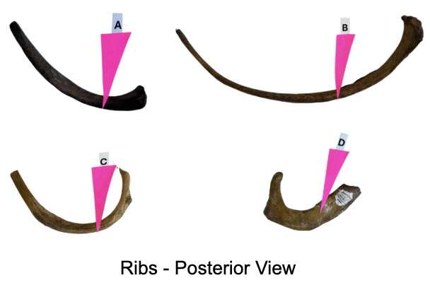 <p>Identify the 2nd rib</p>