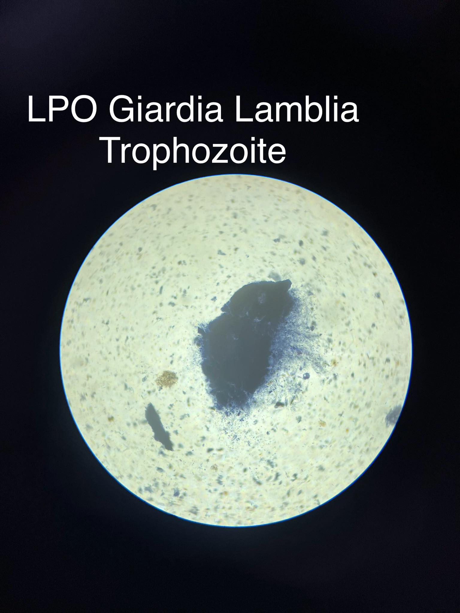 <p>Giardia lamblia</p>