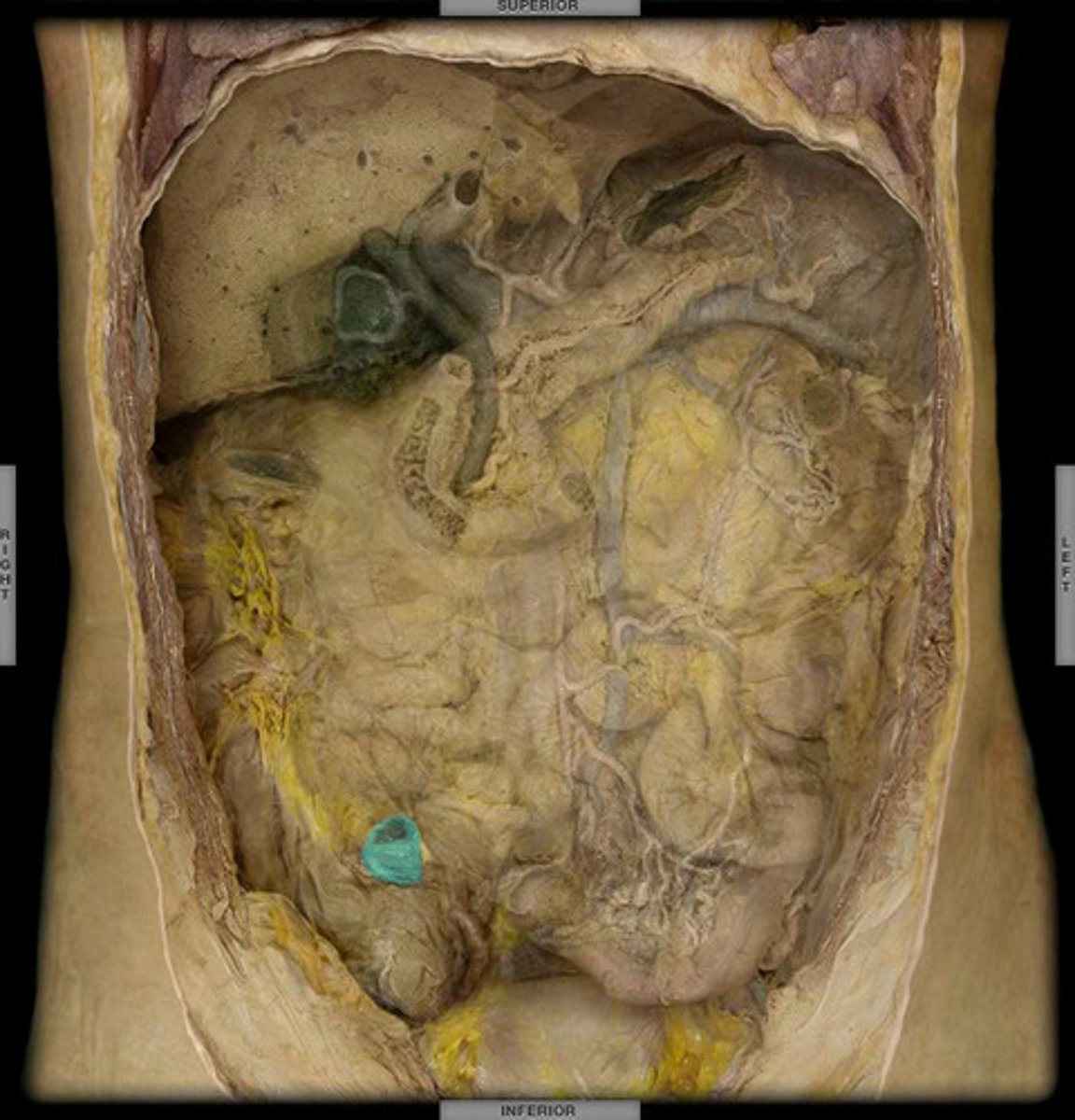 <p>Final segment of the small intestine; fine tune organic absorption (B12,iron,etc) picks up/absorbs any nutrients not already absorbed</p>